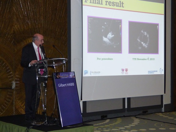 04_eurovalve-2016_28